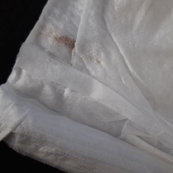 Molfix Bebek Bezinde Yabancı Madde Bulunması