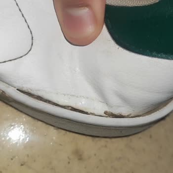 Adidas Ayakkabısında Taban Açılması Ve İç Kumaş Parçalanması Kullanıcı Hatası Olarak Değerlendirildi