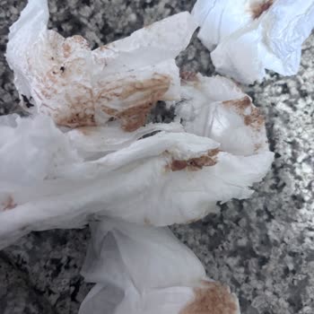 Arzum Starblend Blender Doğrayıcı Aparatının Paslanması Ve Kesim Sorunları İçin Garanti Kapsamında Parça Değişimi Talebi