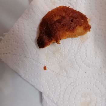 Lezita Piliç Köftesinde Saç Teli Bulunması Hijyen İhlali