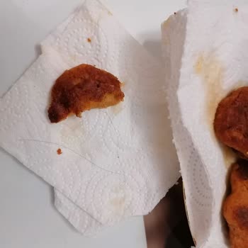 Lezita Piliç Köftesinde Saç Teli Bulunması Hijyen İhlali