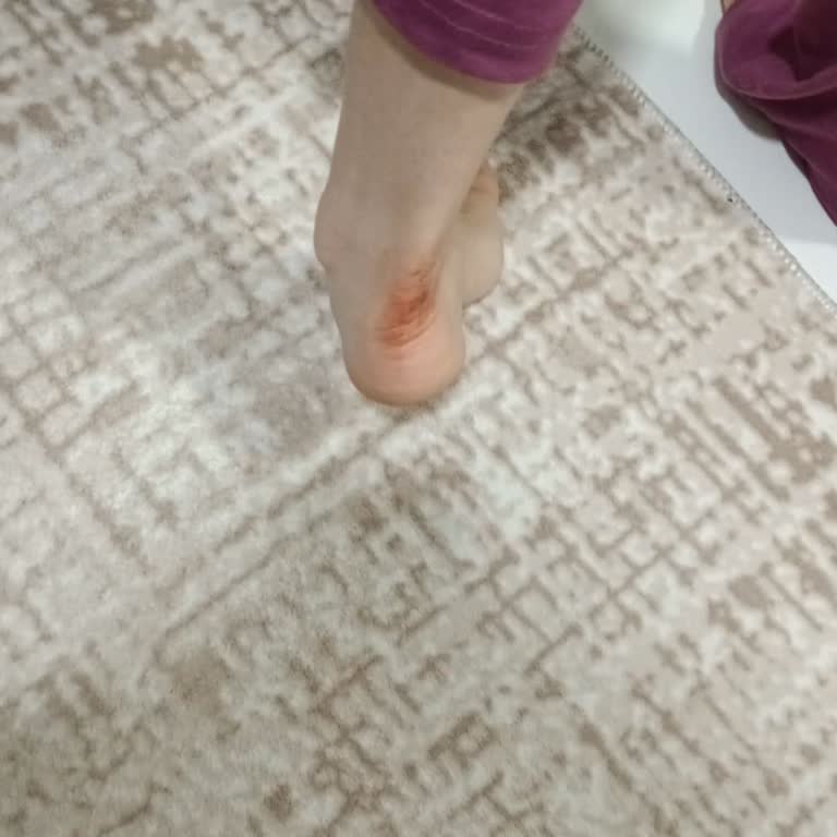 Lumberjack Çocuğumun Ayağını Mahveden Ayakkabı İçin İade Ve Değişim Talebi