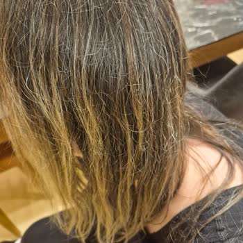 Mood Sapanca Saç Ve Ciltte Ağır Bozulma, Ücret İadesi Ve Tedavi Masrafları Talebi