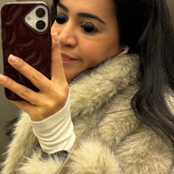 Op Dr Evren Helvacı Göz Altı Dolgusu Sonrası Morarma Ve İade Talebi