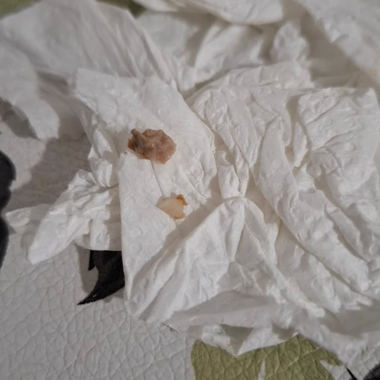 Metro Grossmarket Kıymada Kemik Parçaları Çıktı: Sağlık Riski Ve Kalite Sorunu