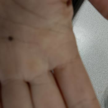 Sütaş Yoğurdunda Taş Parçaları: Sağlık Riski Ve Denetim Soru İşareti