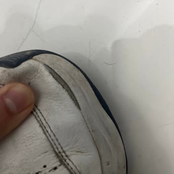 Garantili Adidas Ayakkabısının Açılması Ve Reddedilen Garanti Talebi