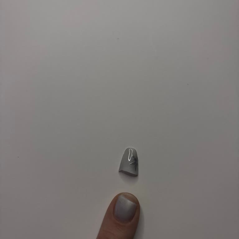 Bursa FSM Şubesinde Beklenmeyen Fiyat Artışı Ve Dayanıksız Protez Tırnak