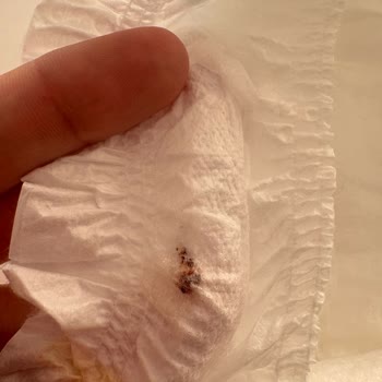 Molfix Bebek Bezinde Kan Benzeri Yabancı Madde