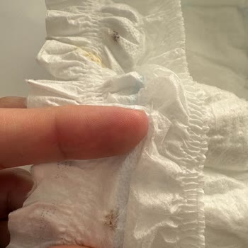 Molfix Bebek Bezinde Kan Benzeri Yabancı Madde