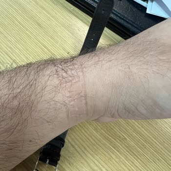 Konyalı Saat Mağazasında Takılan Kordonun Sıkması Ve Açılmaması