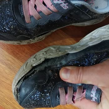 Skechers Ayakkabılarında Yanlardan Açılma Ve Çözüm Sunulmaması
