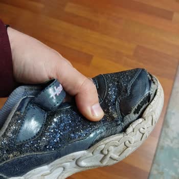 Skechers Ayakkabılarında Yanlardan Açılma Ve Çözüm Sunulmaması