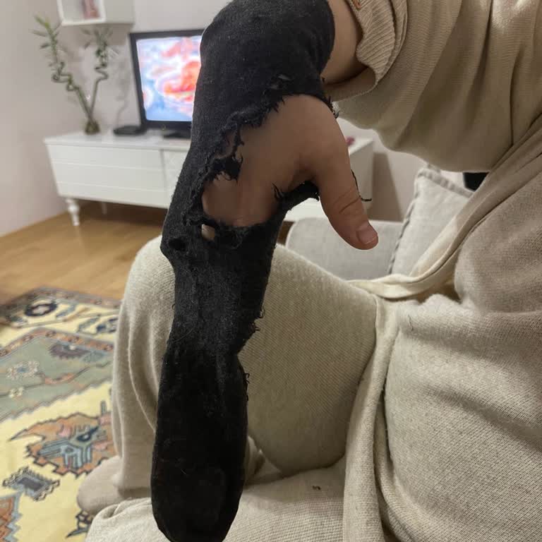 Çamaşır Makinem Kıyafetleri Parçalayarak Çıkartıyor Ve Servis Açmıyor