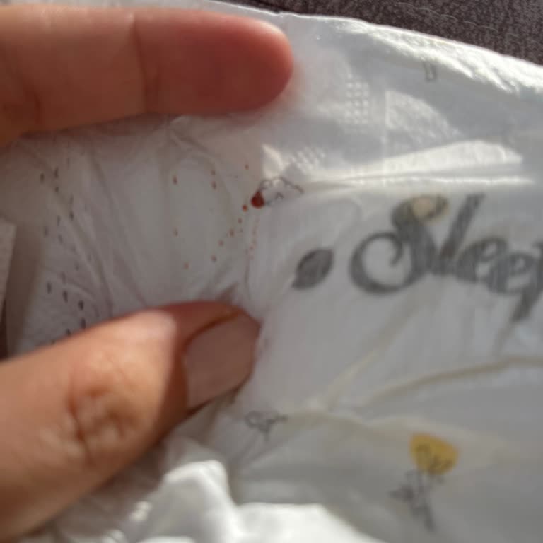 Sleepy Bebek Bezinde Kan Benzeri Leke Ve Hijyen Endişesi