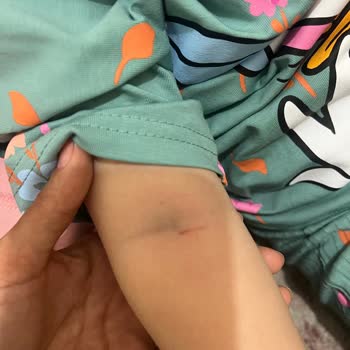 Sultan Süleyman Araştırma Hastanesi Çocuk Acil Servisinde Hemşire Tarafından Olumsuz Üslup!