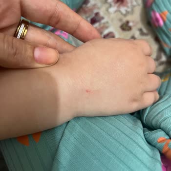 Sultan Süleyman Araştırma Hastanesi Çocuk Acil Servisinde Hemşire Tarafından Olumsuz Üslup!