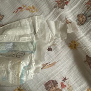 Molfix Premium 4 Numaralı Bebek Bezinde Cırt Cırt Yapışkan Sorunu