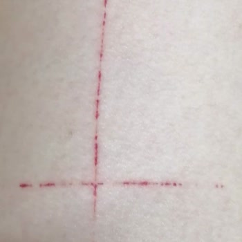 Renew Beauty Hijyen İhlali Ve Yanıltıcı Cihaz Bilgisi