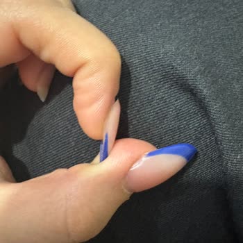 Dilay Avasu Beauty Saygısız Ve Çözüm Odaklı Olmayan Bir Yaklaşımla Karşı Karşıya Kaldım