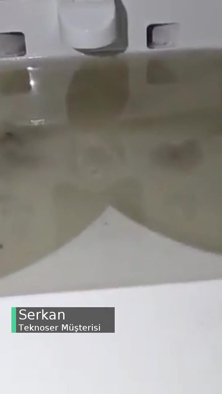Teknoser Servis Hizmetinde Sıkıntı! videonun kapak resmi