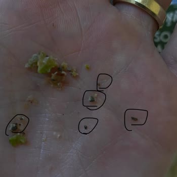 Baklavada Sert Yabancı Cisim Ve Sağlık Riski