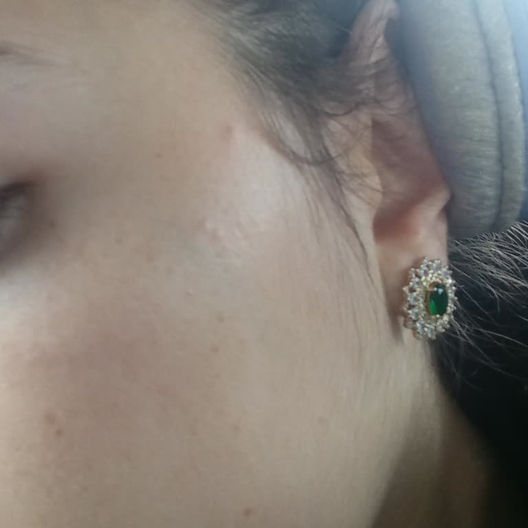 Hassas Deri İçin Yanlış Ürün Satışı Ve İlgisiz Müşteri Hizmetleri