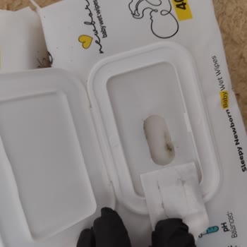 Sleepy Yeni Doğan Islak Mendilde Lekeler Ve Cevapsız Şikayet