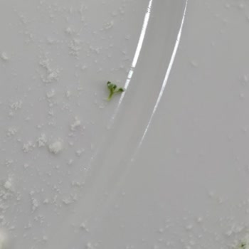 Bebelac Gold Konfor 1'de İçinden Çıkan Yeşil Parçalar Ve Bebek Gazı