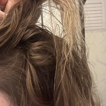 Yves Rocher Şampuanı Yağlı Bırakıyor Ve Saç Dökülmesini Azaltmıyor