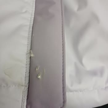 Çocuk Montunda Erken Yıpranma Ve Mağazanın Kullanıcı Hatası İddiası