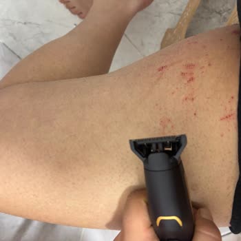 Babyliss Erkek Bakım Kitinde Cilt Kesilmesi Ve İade Talebi