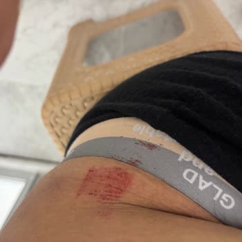 Babyliss Erkek Bakım Kitinde Cilt Kesilmesi Ve İade Talebi