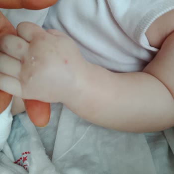 Trabzon Kanuni Araştırma Hastanesi Bebek Damar Yolu Açma Sorunları Ve Doktor İhmali