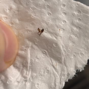BİM Lezzethane Pizza’da Böcek Sorunu Ve Hijyen İhmaline Yanıt Bekleniyor