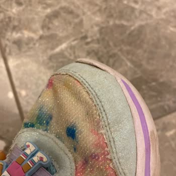 Skechers Çocuk Ayakkabısında Koku Ve Deforme Olma Sorunu, Üretim Kusuru Reddi