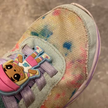 Skechers Çocuk Ayakkabısında Koku Ve Deforme Olma Sorunu, Üretim Kusuru Reddi