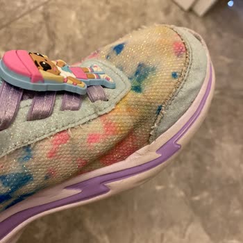 Skechers Çocuk Ayakkabısında Koku Ve Deforme Olma Sorunu, Üretim Kusuru Reddi