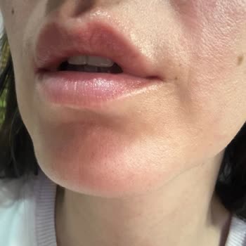 The NewLab. Retinol Serum Cildimde Hasara Yol Açtı!