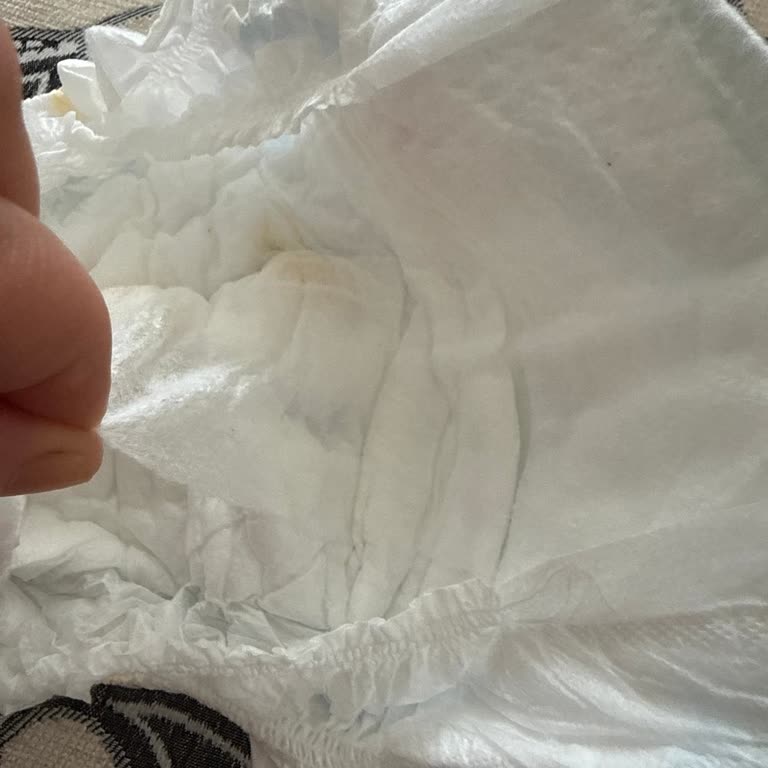 Molfix 3 Numaralı Bebek Bezinde Orta Bölümden Sızdırma Ve İz Sorunu