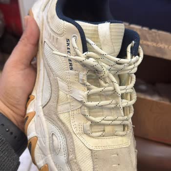 Skechers Ayakkabıda Deformasyon Ve Garanti Reddi!