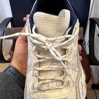 Skechers Ayakkabıda Deformasyon Ve Garanti Reddi!