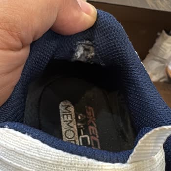 Skechers Ayakkabıda Deformasyon Ve Garanti Reddi!