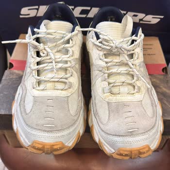 Skechers Ayakkabıda Deformasyon Ve Garanti Reddi!