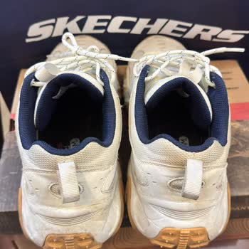 Skechers Ayakkabıda Deformasyon Ve Garanti Reddi!
