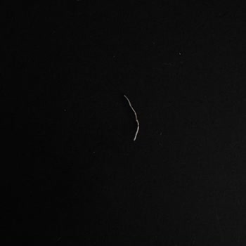 Kazandibi Paketi İçinde Metal Zımba Parçası Bulunması Ve Ağız Yaralanması