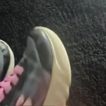 Skechers Ayakkabının 2 Yıl Garantisi Hiçbir İle Yaramıyor!