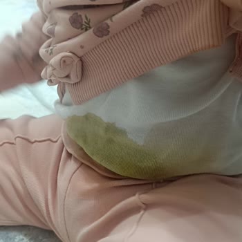 Molfix 4 Numaralı Bebek Bezinde Sürekli Sızdırmazlık Sorunu Ve İade Talebi