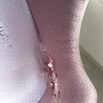 Skechers Arch Fit Ayakkabısının Ağrıyı Artırması Ve Ücret İadesi Talebi