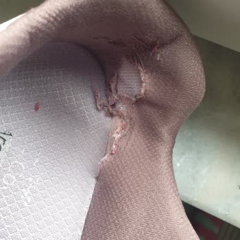 Skechers Arch Fit Ayakkabısının Ağrıyı Artırması Ve Ücret İadesi Talebi